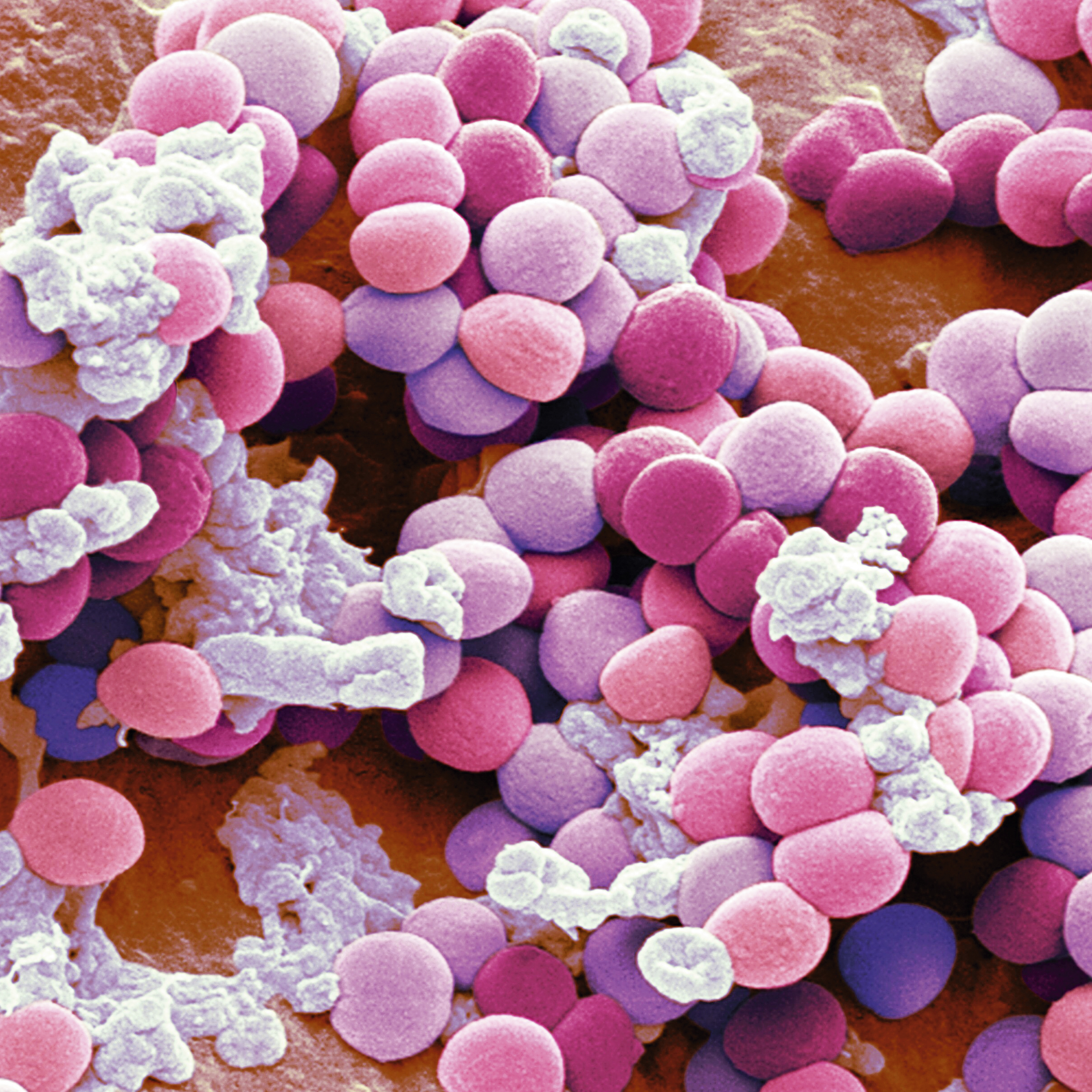 Blink Activity | BlinkLearning