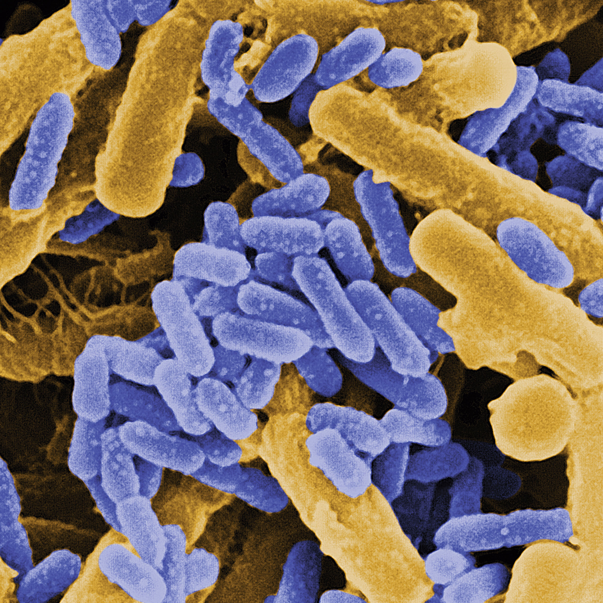 Blink Activity | BlinkLearning