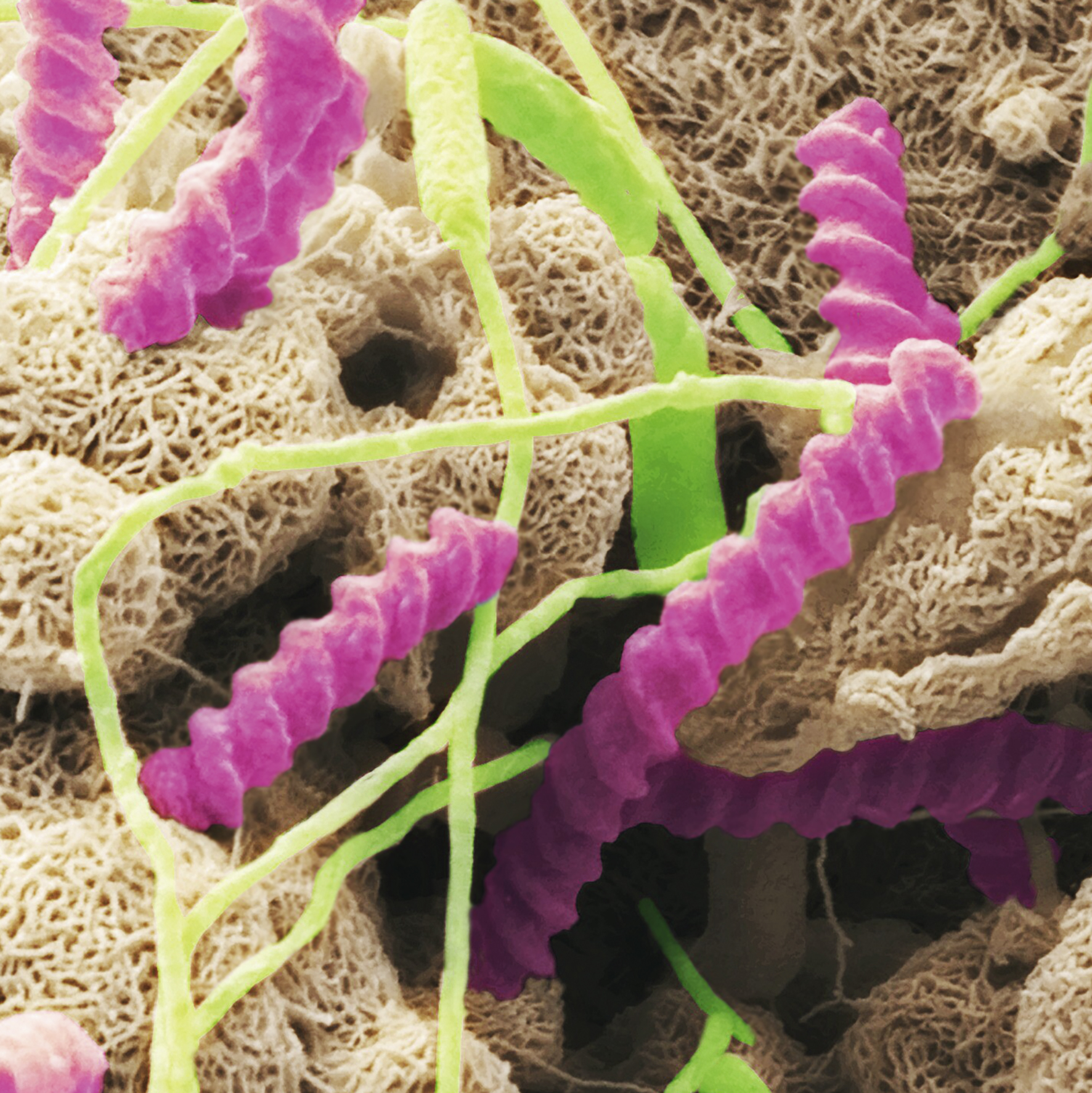 Blink Activity | BlinkLearning