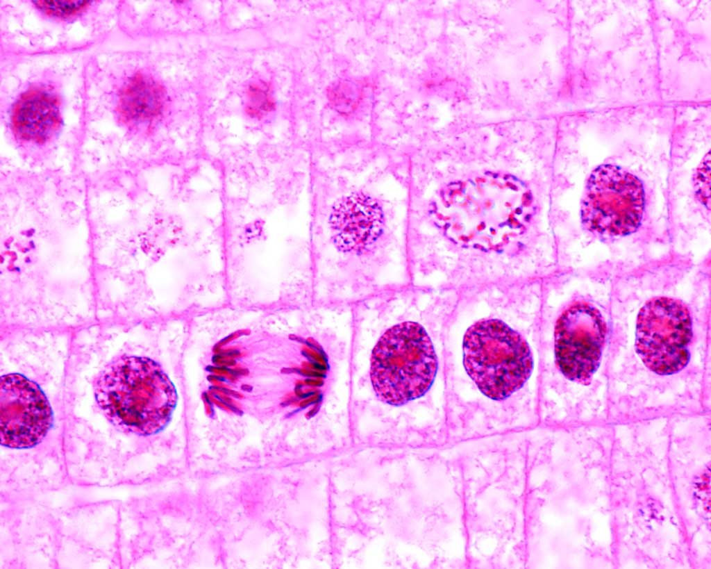 Promtaohase Prometaphase Of Mitosis Under Microscope